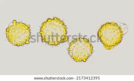 Pollen grain of Bay Biscayne creeping-oxeye flower (Sphagneticola trilobata). 400x magnification + 4x camera zoom