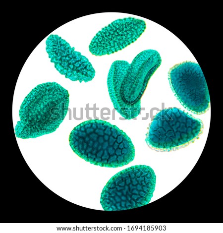 Pollen grains under the light microscope. Grains of pollen often cause allergic reactions to the antigens embedded on the outer casing of microscopic grains leading to hay fever and pollinosis. Photo.