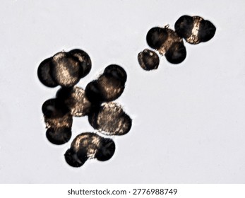 Pollen grains under microscope causing seasonal allergies - optical microscope 400x magnification