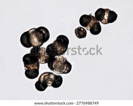 Pollen grains under microscope causing seasonal allergies - optical microscope 400x magnification