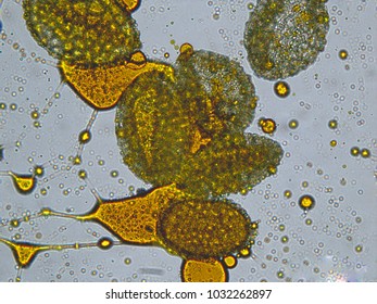 Pollen Of A Lily Under A Microscope