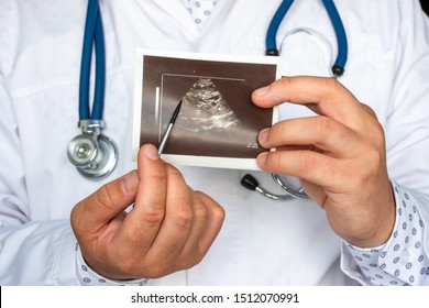 Polycystic Kidney Disease On Ultrasound Image Concept Photo. Doctor Indicating By Pointer On Printed Picture Of Ultrasound Pathology Of Many Cysts In Kidneys. For Diagnosis, Radiology, Nephrology