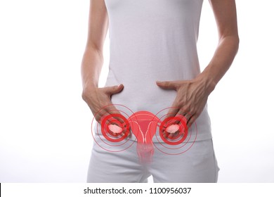 Polycystic ovary syndrome. Gynecology , female health and anatomy concept. Woman's body with uterus and ovary illustartion, isolate on white background