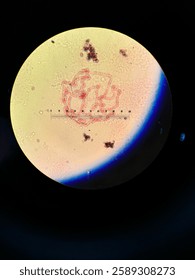 Polytene Chromosome under a microscope 