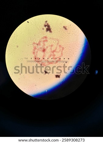 Polytene Chromosome under a microscope 