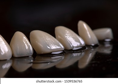 Porcelain Veneers Macro On A Black Background