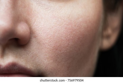 pores on the face. oily skin of the face - Shutterstock ID 756979504