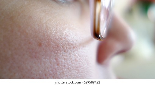 Pores On The Skin Of A Face