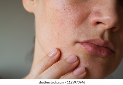 pores on the skin of the face. Cleansing the face skin - Shutterstock ID 1125973946