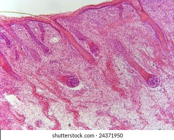 Portion Human Lip Showing Hair Follicles Stock Photo 24371950 ...