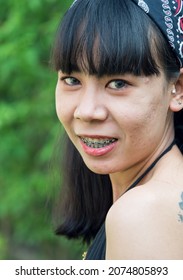 Portrait 20-25-year Girl Asian Woman With Long Black Hair Wearing Black Shirt, Blue Jeans, Acne Scars Faces, Standing In  Garden Tree. Spring Or Summer In The Evening Of The Day At Bangkok Thailand

