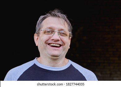 Portrait Of An Adult Male Face, Strabismus Or Exotropia