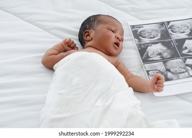 Portrait Of African New Born Baby  With Blanket Lying On Bedroom With Fetal Ultrasound Image For Pregnancy. White Background