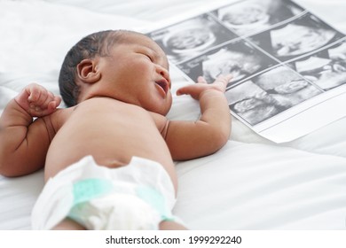 Portrait Of African New Born Baby  With Diaper Lying On Bedroom With Fetal Ultrasound Image For Pregnancy. White Background