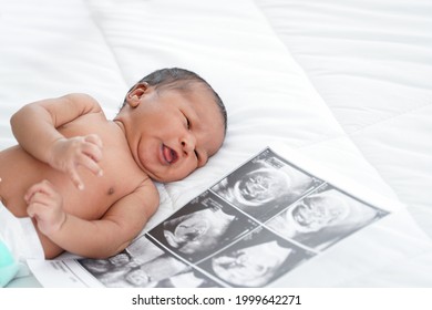 Portrait Of African New Born Baby With Diaper Lying On Bedroom With Fetal Ultrasound Image For Pregnancy. White Background