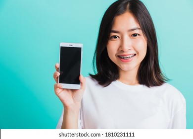 Portrait Of Asian Teen Beautiful Young Woman Smile Have Dental Braces On Teeth Laughing She Hold And Show Smart Mobile Phone Blank Screen, Isolated On Blue Background, Medicine And Dentistry Concept