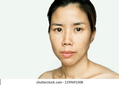 Portrait Asian Woman with Freckle Face Skin