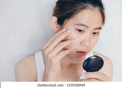 Portrait Of Asian Woman Worry About Her Face When She Saw The Problem Of Acne And Scar By The Mini Mirror. Conceptual Shot Of Acne And Problem Skin On Female Face.