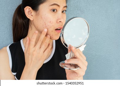 Portrait of Asian woman worry about her face when she saw the problem of acne inflammation and scar by the mini mirror. Conceptual shot of Acne & Problem Skin on female face.