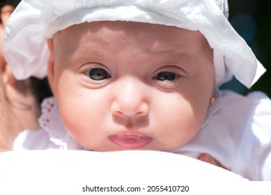 Portrait of a baby girl with blocked tear ducts of one eye