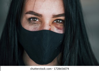 Portrait Of Beaten Young Woman In Black Protective Mask With Bruise Under Eye Indoors In Abandoned Building.