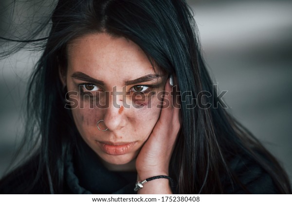 Portrait Beaten Young Woman Bruise Under Stock Photo 1752380408 ...