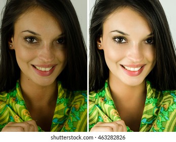 Portrait Of A Beautiful Brunette Girl Before And After Retouching With Photoshop. Bad Photo Vs Good Photo, Acne Beauty Treatment. Isolated On White Background. Edited Photos Being Compared.