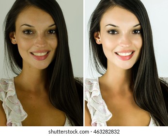 Portrait Of A Beautiful Brunette Girl Before And After Retouching With Photoshop. Bad Photo Vs Good Photo, Acne Beauty Treatment. Isolated On White Background. Edited Photos Being Compared.