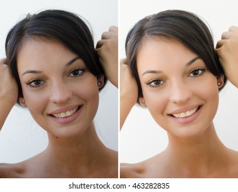 Portrait Of A Beautiful Brunette Girl Before And After Retouching With Photoshop. Bad Photo Vs Good Photo, Acne Beauty Treatment. Isolated On White Background. Edited Photos Being Compared.