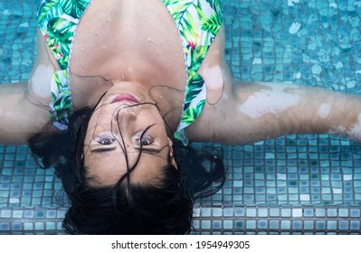 Portrait Of Beautiful Brunette Mature Woman With Vitiligo Pigment Spot Disease And Long Black Hair Lies In The Spa Pool In Bathing Suit Swimwear