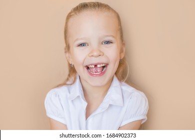 Portrait Of Beautiful Emotional Baby Girl  That Lost First Tooth