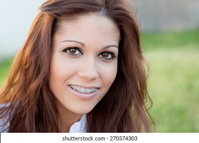 Portrait of a beautiful girl with brackets at the park - Shutterstock ID 270374303