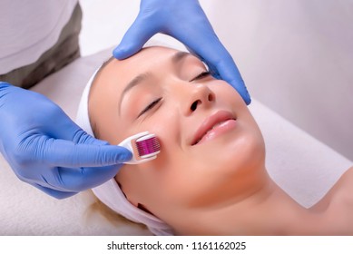 Portrait Of Beautiful Woman In Beauty Salon During Mesotherapy Procedure With Derma Roller