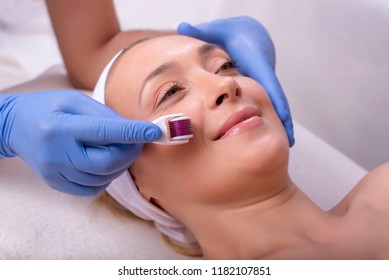 Portrait Of Beautiful Woman During Face Skin Treatment Procedure With Derma Roller