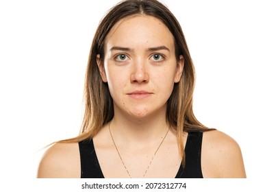 Portrait of a beautiful woman with no makeup, amd problematic skin on a white background