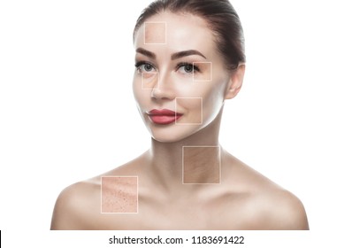 Portrait of a beautiful woman on a white background, on the face are visible areas of problem skin - wrinkles and freckles. Cosmetology concept. - Shutterstock ID 1183691422