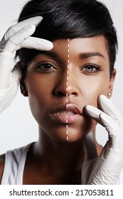 Portrait Of A Black Woman With A Half Of A Face With A Whitening Skin And Blue Eye