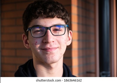 Portrait Of A Caicasic Boy In Puberty: On The Skin Of The Face We Can Recognize Small Pimples, Red Spots, Acne.