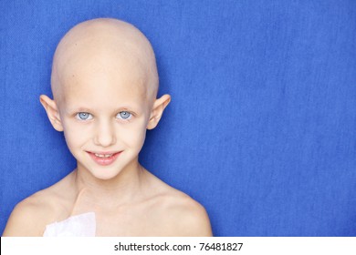 Portrait Of A Caucasian Child Without Hair Due To Chemotherapy Treatment