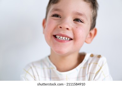 Portrait Of A Cute Boy Smiling With White Healthy Teeth. Emotions Of A Child. Smiling Child Boy. Cheerful Cheerful Kid. Happy Child. Funny Baby Boy Isolated On A White Background