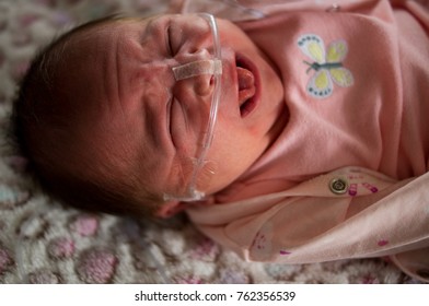 Portrait Of Cute Newborn Girl Crying With Oxygen Tube Supplied