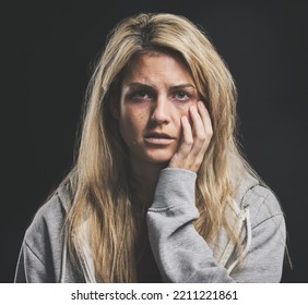 Portrait, Depression And Woman With Mental Health, Trauma And Dark Thoughts Alone In An Asylum Or Psychiatric Hospital. Suicide, Bipolar And Crazy Girl With Stress, Depressed And Personality Disorder