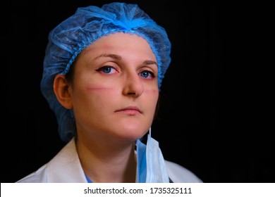 Portrait Of A Doctor With Cuts And Red Eyes. Close-up Of A Nurse In A Face Mask On A Black Background With Traces Of Protective Clothing.