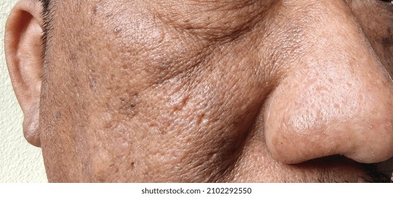 portrait dull face and rough skin of Middle-aged man, problem skin care, cellulite and pimple under the eyes. - Shutterstock ID 2102292550