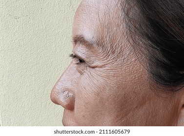 Portrait Dull Face And Rough Skin Of Woman, Problem Aging Skin Of Elderly.