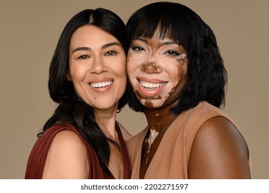 Portrait Of A Filipino Woman In Her 50's And An African American Woman With Vitiligo In Her 30's Smiling Together On A Neutral Background.