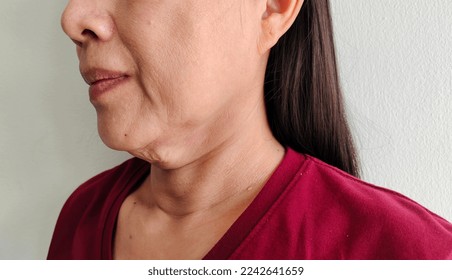 portrait the flabbiness adipose hanging skin, cellulite and flabby skin under the neck, the mole on the body, wattle and cellulite under the chin of Middle-aged woman, health care and medical concept. - Shutterstock ID 2242641659
