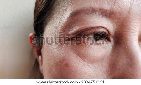 portrait the flabbiness and wrinkle beside the eye, swelling and edema under the eyes, ptosis and flabby skin beside the eyelid, freckles and blemish on the face of the woman, health care and beauty.