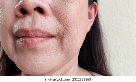 portrait the flabbiness and wrinkle beside the mouth, smile lines and flabby skin corner the lip , blemish and dark spots, wrinkles skin on the face of the woman, health care and beauty concept. - Powered by Shutterstock