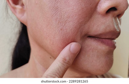 portrait the flabbiness and wrinkle  corner  of the mouth, smile lines and flabby skin beside the mouth , dark spots and dull skin, freckles and blemish on the face, health care and beauty concept.